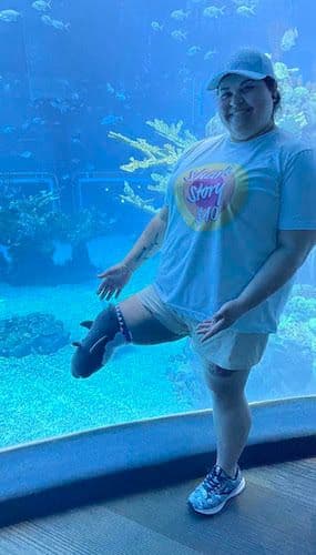 amputee diver